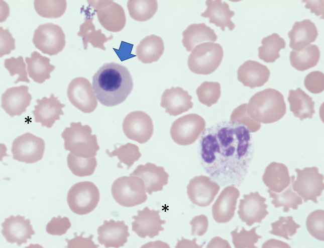 Nucleated red cells Blood Project