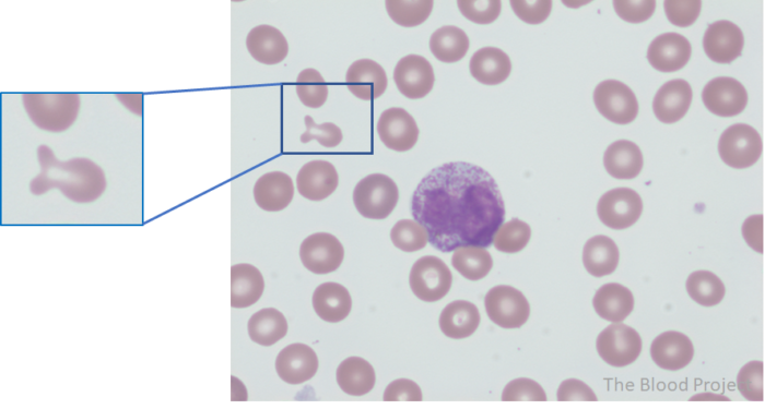 Fish-Shaped Red Cells • The Blood Project