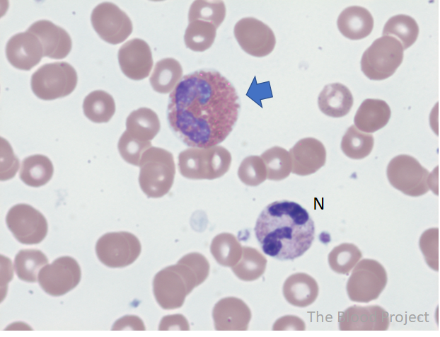 Eosinophils The Blood Project Eosinophils The Blood Project