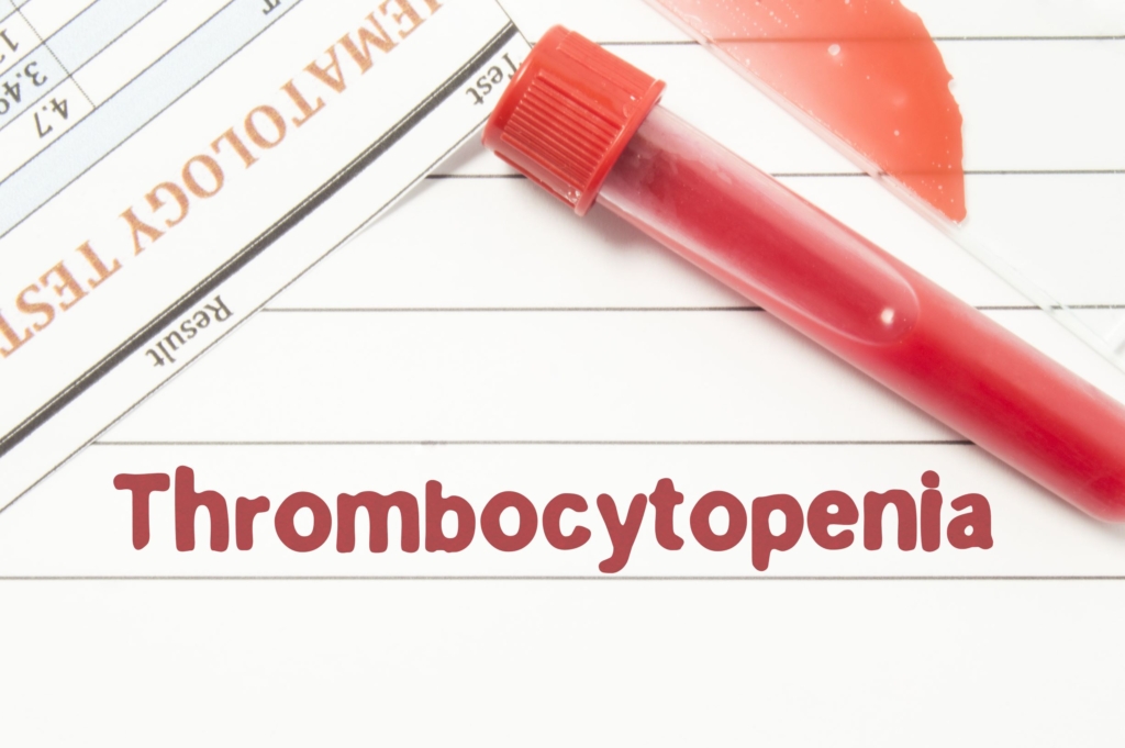 A 56 year-old man arrives to the emergency room with confusion. He is found to have anemia and thrombocytopenia and is referred to you for further evaluation.