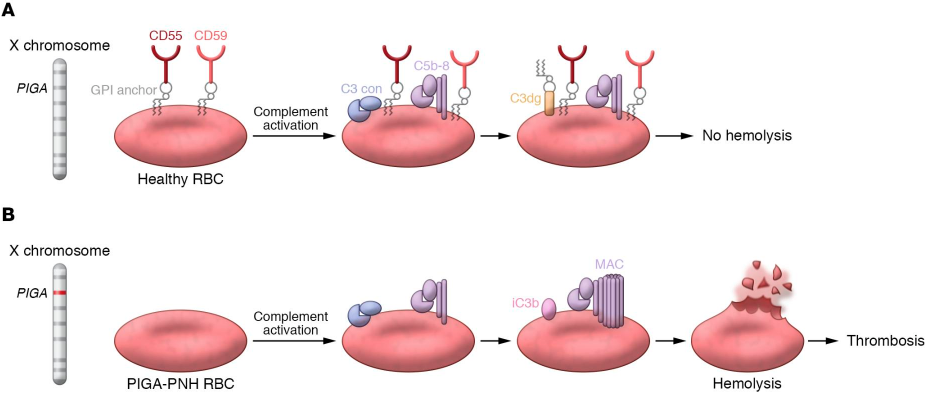 What causes paroxysmal nocturnal hemoglobinuria (PNH)? • The Project