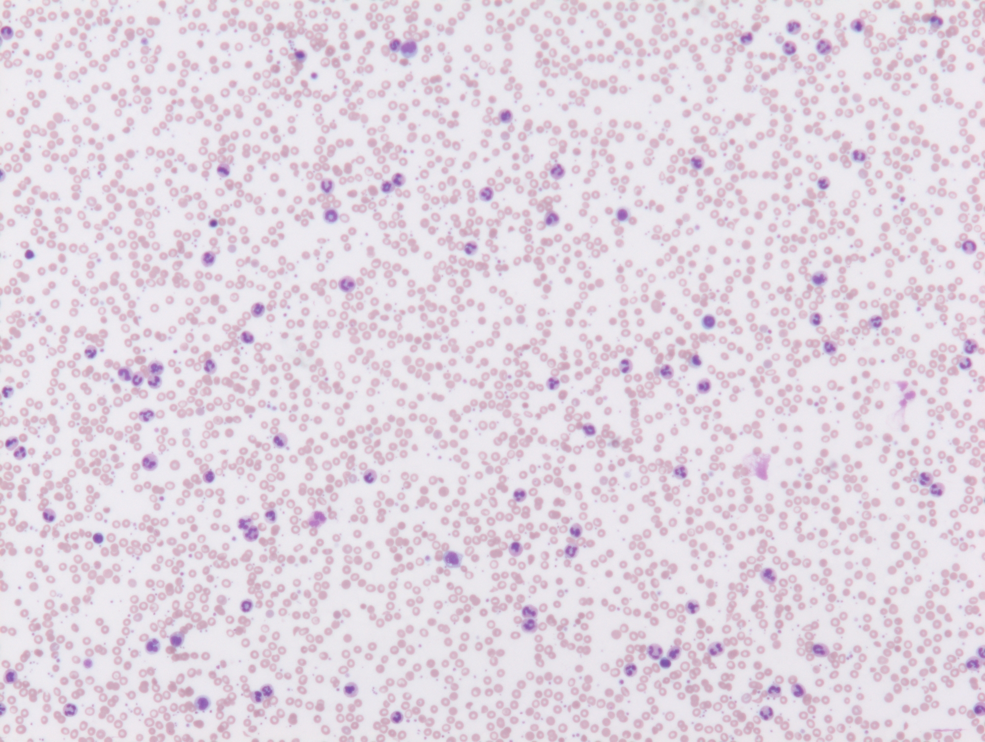 Peripheral smear quiz • The Blood Project