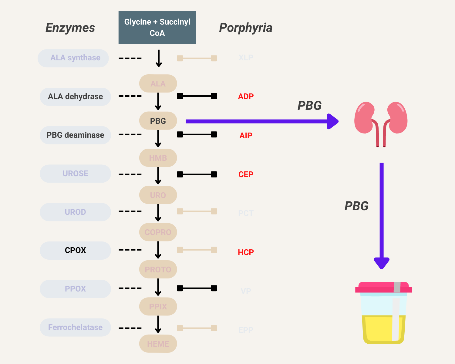 Porphyria Urine