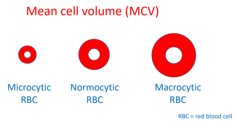What Is The Mean Cell Volume MCV The Blood Project what-is-the-mean-cell-volume-mcv-the-blood-project