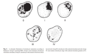 Microcysts Rces Postscript • The Blood Project