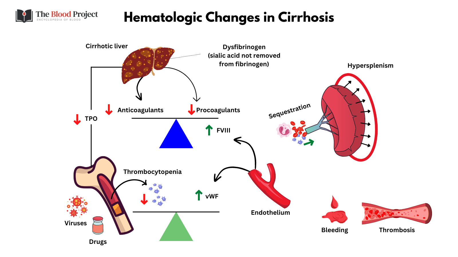 cirrhosis-and-hematology-the-blood-project
