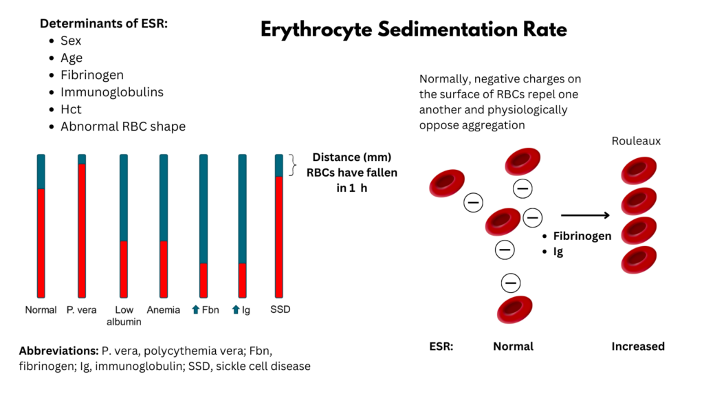 Erythrocyte Sedimentation Rate • The Blood Project