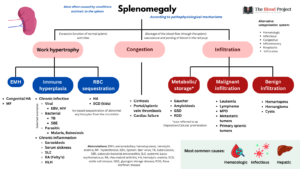 Approach to Splenomegaly • The Blood Project