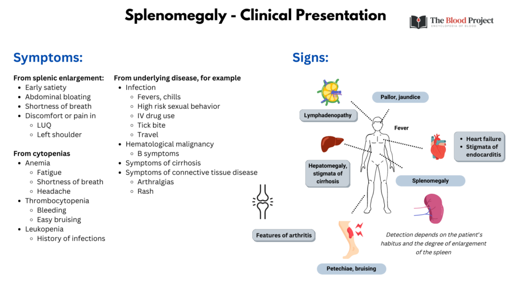 History and Physical Examination in Patient with Splenomegaly • The ...