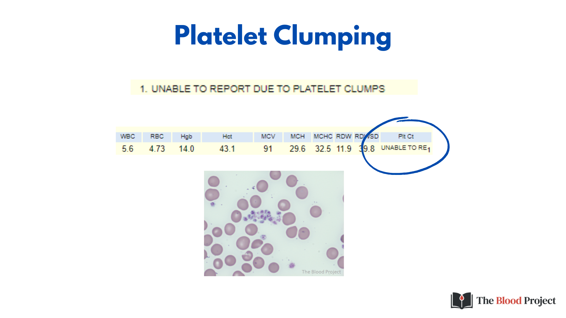 Platelet Count • The Blood Project