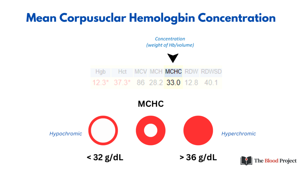 Mean Corpuscular Hemoglobin Concentration MCHC 47 OFF