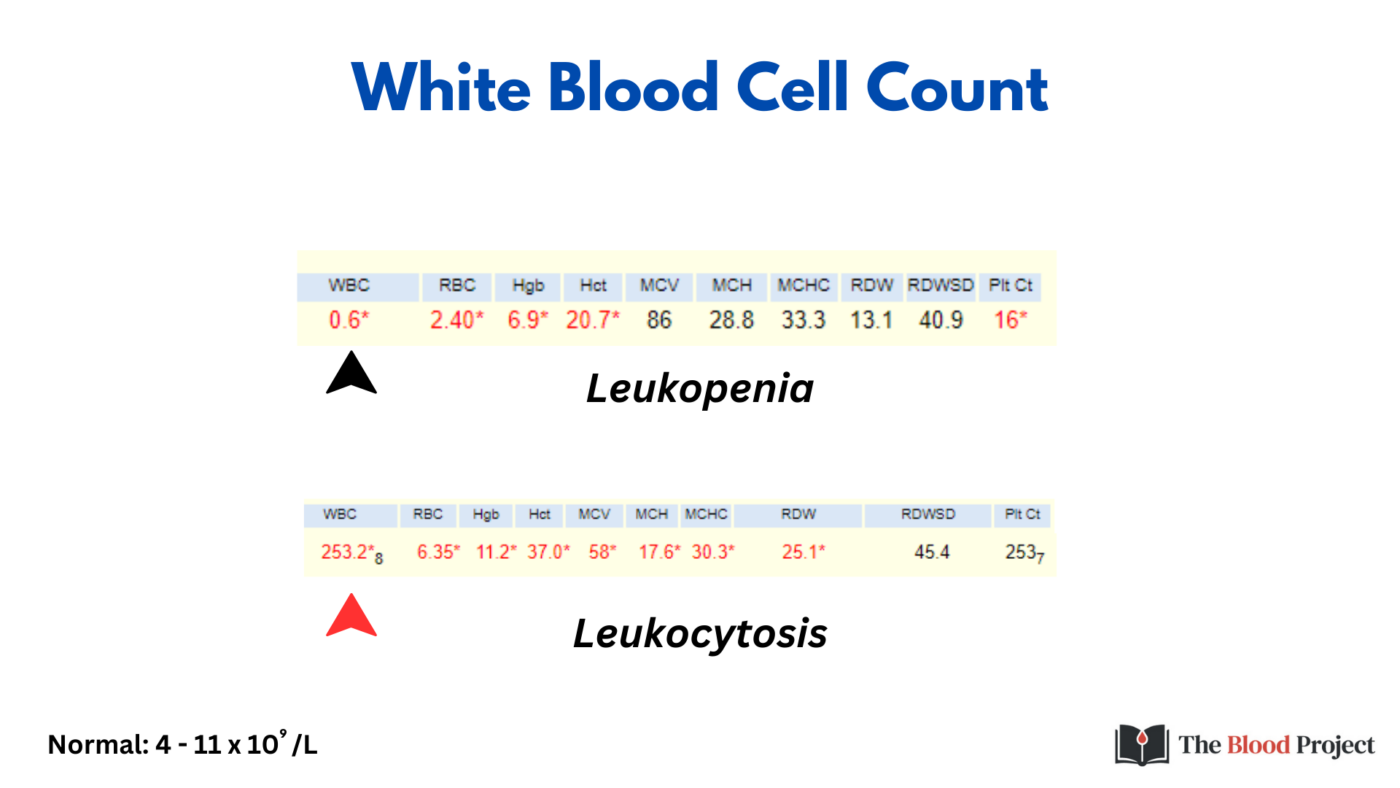 Ms High White Blood Cell Count Tutorial • The Blood Project