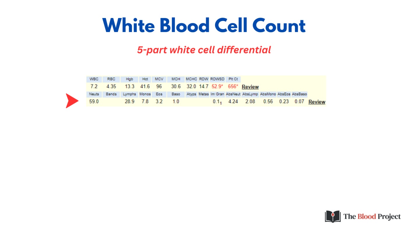 Ms High White Blood Cell Count Tutorial • The Blood Project