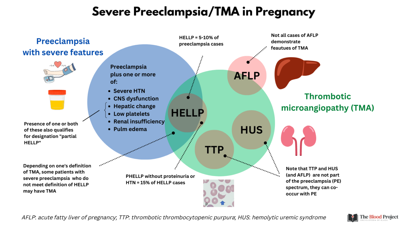 Tma in pregnancy the blood project
