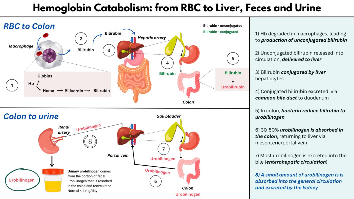 Urobilinogen in hemolytic anemia the blood project