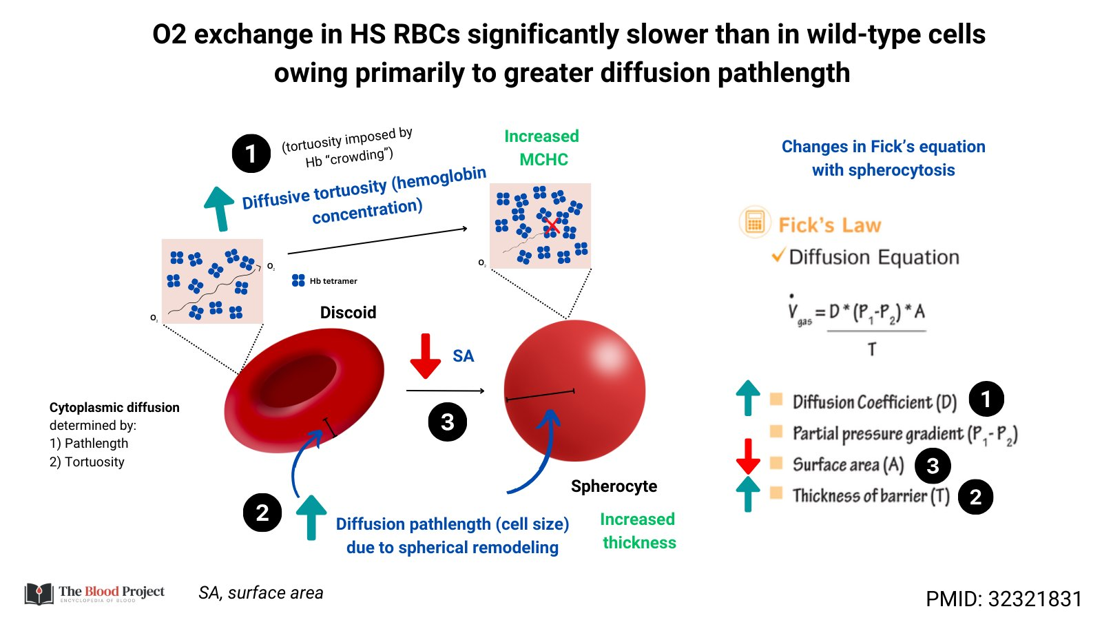 Oxygen Exchange in Hereditary Spherocytosis (HS) • The Blood Project