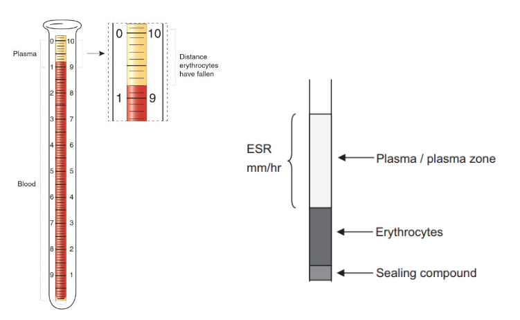 ESR • The Blood Project