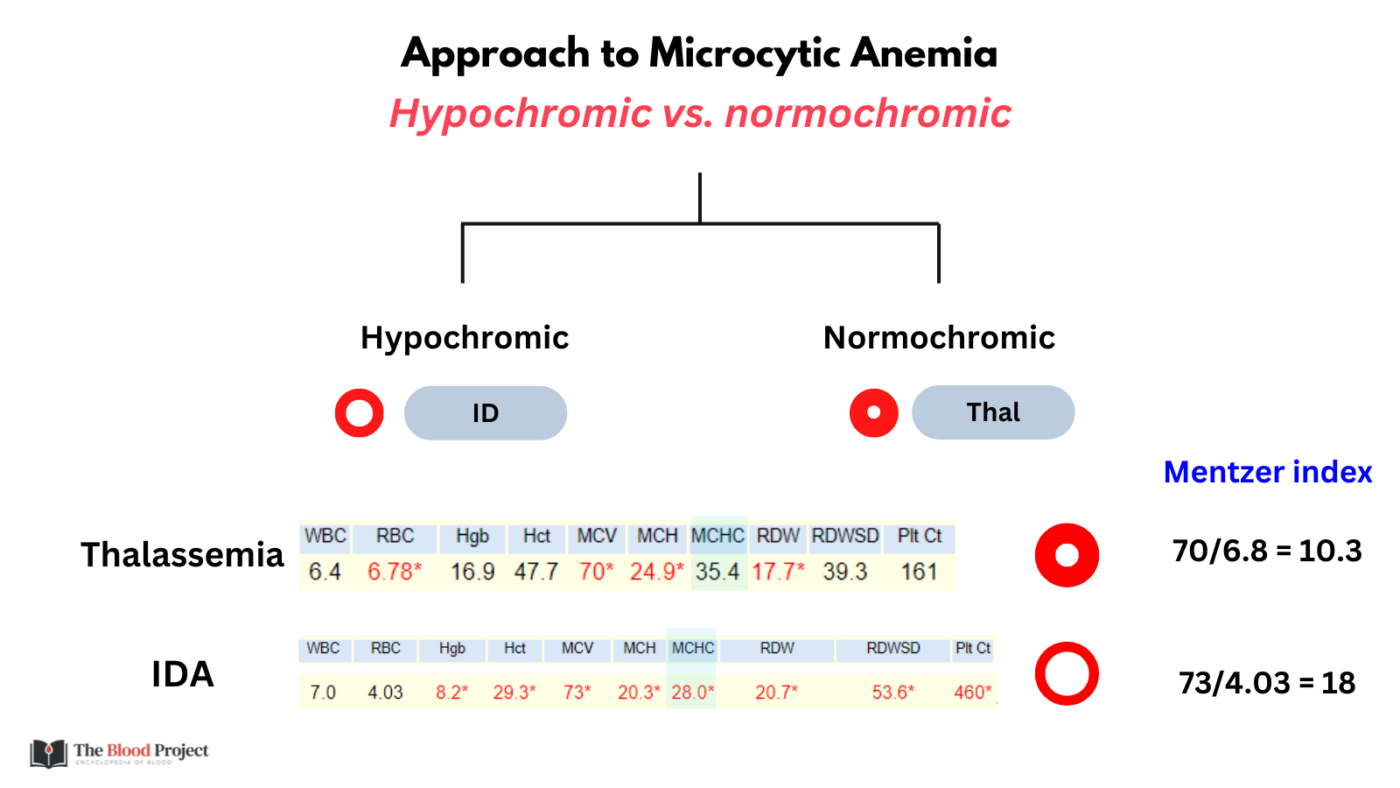 System 2 Thinking Approach to Thalassemia Minor vs. Iron Deficiency