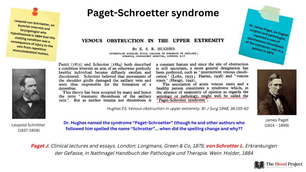Eponyms in Hematology PagetSchroetter Syndrome • The Blood Project